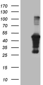 AMDHD1 Antibody in Western Blot (WB)