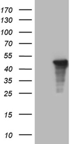 AMDHD1 Antibody in Western Blot (WB)