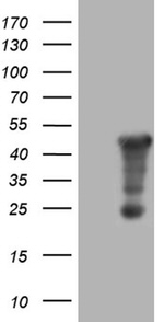 AMDHD1 Antibody in Western Blot (WB)