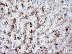 AMOT Antibody in Immunohistochemistry (Paraffin) (IHC (P))