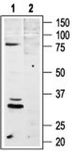 MC4 Receptor (extracellular) Antibody in Western Blot (WB)