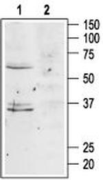 MC4 Receptor (extracellular) Antibody in Western Blot (WB)