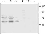 Dopamine Transporter (DAT) (extracellular) Antibody in Western Blot (WB)