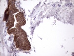 AMTN Antibody in Immunohistochemistry (Paraffin) (IHC (P))