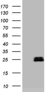 AMTN Antibody in Western Blot (WB)