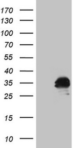 AMTN Antibody in Western Blot (WB)