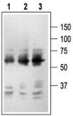 p75 NGF Receptor (extracellular) Antibody in Western Blot (WB)