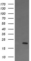 ANAPC11 Antibody in Western Blot (WB)