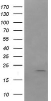 ANAPC11 Antibody in Western Blot (WB)