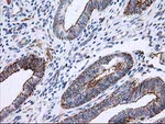 ANAPC2 Antibody in Immunohistochemistry (Paraffin) (IHC (P))