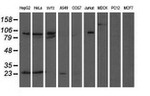 ANAPC2 Antibody in Western Blot (WB)