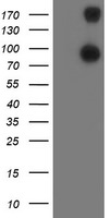 ANAPC2 Antibody in Western Blot (WB)