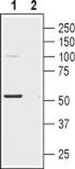 Nicotinic Acetylcholine Receptor alpha 2 (CHRNA2) (extracellular) Antibody in Western Blot (WB)