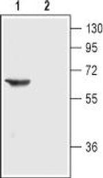 Nicotinic Acetylcholine Receptor alpha 3 (CHRNA3) (extracellular) Antibody in Western Blot (WB)