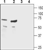 Nicotinic Acetylcholine Receptor beta 1 (CHRNB1) (extracellular) Antibody in Western Blot (WB)