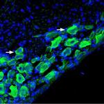 Nicotinic Acetylcholine Receptor alpha 9 (CHRNA9) Antibody in Immunohistochemistry (Frozen) (IHC (F))