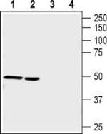 Nicotinic Acetylcholine Receptor alpha 9 (CHRNA9) Antibody in Western Blot (WB)