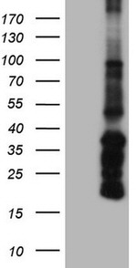 ANGPT1 Antibody in Western Blot (WB)