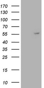 ANGPT1 Antibody in Western Blot (WB)