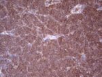 ANGPT2 Antibody in Immunohistochemistry (Paraffin) (IHC (P))