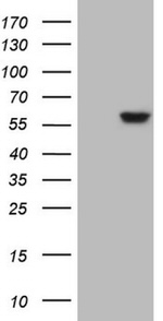 ANGPTL3 Antibody in Western Blot (WB)