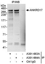 ANKRD17 Antibody in Immunoprecipitation (IP)