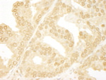 ANKRD17 Antibody in Immunohistochemistry (IHC)