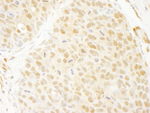 ANKRD17 Antibody in Immunohistochemistry (IHC)