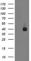 ANKRD53 Antibody in Western Blot (WB)