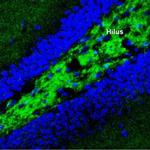 Synaptotagmin-1 (SYT1) Antibody in Immunohistochemistry (Frozen) (IHC (F))