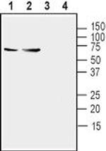 Synaptotagmin-1 (SYT1) Antibody in Western Blot (WB)