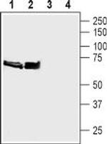 Synapsin I (SYN1) Antibody in Western Blot (WB)