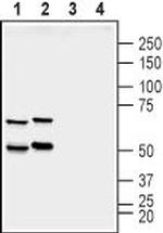 Synapsin II (SYN2) Antibody in Western Blot (WB)