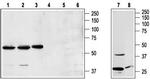 NPY1R Antibody in Western Blot (WB)