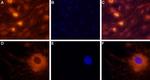 NPY2R Antibody in Immunocytochemistry (ICC/IF)