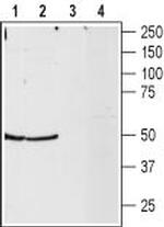 NPY2R Antibody in Western Blot (WB)