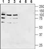 NRG1 (Neuregulin-1) (extracellular) Antibody in Western Blot (WB)