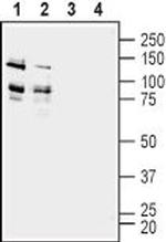 ADAM22 (extracellular) Antibody in Western Blot (WB)