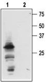 proNGF Antibody in Western Blot (WB)