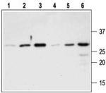 proNGF Antibody in Western Blot (WB)