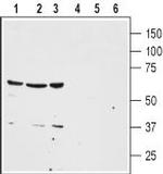 Neurotensin Receptor 1 (extracellular) Antibody in Western Blot (WB)