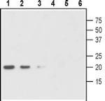 proGDNF Antibody in Western Blot (WB)