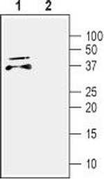 CDNF Antibody in Western Blot (WB)