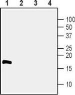 CDNF Antibody in Western Blot (WB)