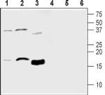 MANF/ARMET Antibody in Western Blot (WB)