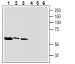 Tumor Necrosis Factor Receptor 2 (extracellular) Antibody in Western Blot (WB)