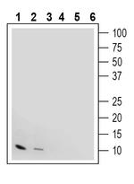 IGF1 Antibody in Western Blot (WB)