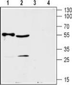 ENT2 (SLC29A2) Antibody in Western Blot (WB)