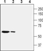 SLC28A2 (CNT2) Antibody in Western Blot (WB)