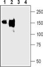 NKCC2 (SLC12A1) (extracellular) Antibody in Western Blot (WB)